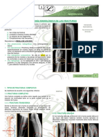 Semiologia Radiologica de Fracturas