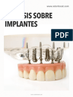 Odontocat Curso Online Protesis Sobre Implantes