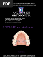 Anclaje en Ortodoncia