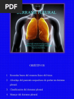 Derrame Pleural