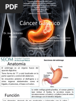 Cáncer de Estómago