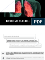 Derrame Pleural