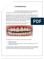 Enfermedades Periodontales