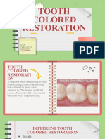 Tooth Colored Restoration