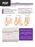 DISTOCIAS