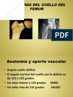 Fracturas Del Cuello Del Femur