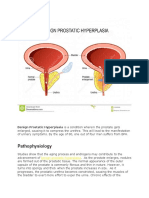 Benign Prostatic Hyperplasia. NCM 109