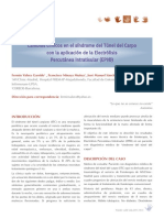 Electrolisis Percutanea Intratisular en Sindrome Del Tunel Del Carpo