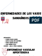 Enfermedades de Los Vasos Sanguíneos.