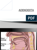 ADENOIDITA