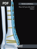 6TecnicaDistalTidis II - CM