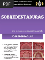 Clase 14 - Sobredentaduras