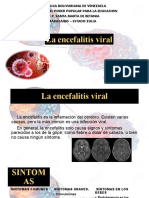 Encefalitis Viral