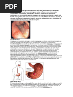 Gastritis Ulcera