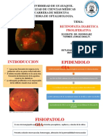 Retinopatia Diabetica Proliferativa