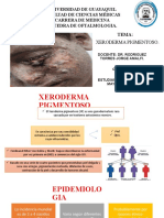 Xeroderma Pigmentoso - Oftalmologia