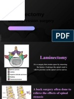 Laminectomy