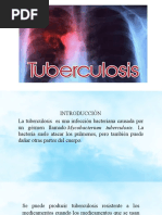 Presentacion de La Tuberculosis