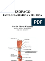 Esofago Patologia Benigna y Maligna