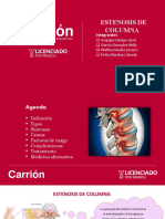 Estenosis de Colmna