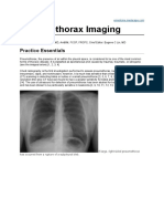 Pneumothoraks Jurnal Radiologi