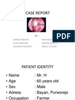 Chronic Rhino Sinusitis With Suspect Ion Nasal Polyps New