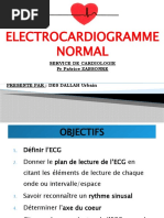 Ecg Normaltopo