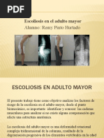 Escoliosis en Adulto Mayor