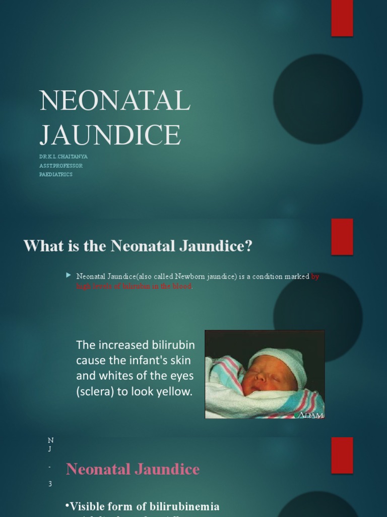 Neonatal Jaundice | PDF | Medical Specialties | Clinical Medicine