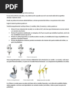 Protesis de Rodilla