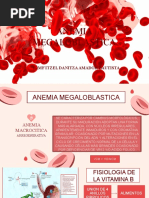 Anemia Megaloblastica