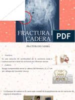 Fractura de Cadera