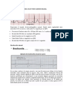 Interpretación Del Electrocardiograma