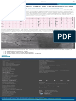 A 54-Year-Old Man With An NSTEMI and Upcoming Non-Cardiac Surgery - American College of Cardiology