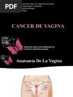 Cancer de Vagina