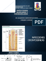 Infeccion Maxilar y Perimaxilar