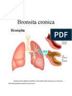 Bronsita Cronica - Igiena