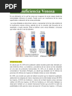 Insuficiencia Venosa Trabajo