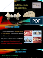 Resin Bonded FPD