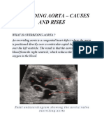 Overriding Aorta - Causes and Risks