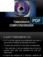 Tomografia Computadorizada