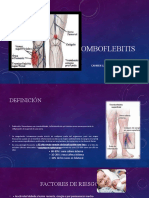 TROMBOFLEBITIS