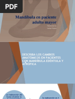 Mandíbula en Paciente Adulto Mayor