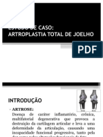 ESTUDO de CASO Artroplastia de Joelho