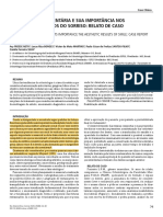 Reanatomização Dentária e Sua Importância Nos Resultados Estéticos Do Sorris: Relato de Caso