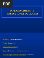 Inflamaciones e Infecciones Oculares