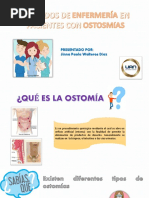 OSTOMÍAS