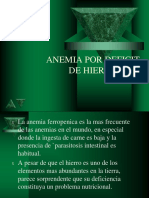 Anemia Por Deficit de Hierro