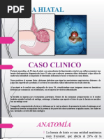 Hernia Hiatal