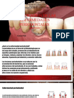 Clasificación de Las Enfermedades Periodontales